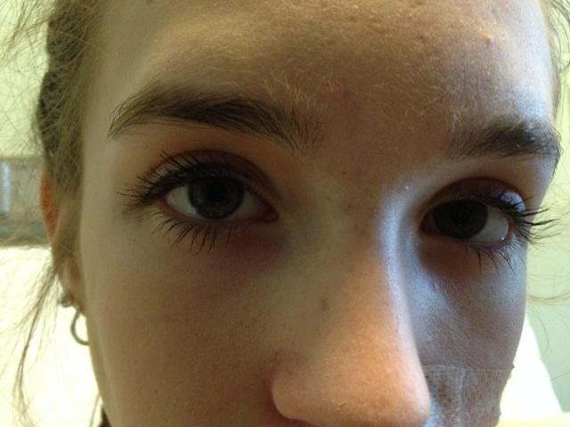 The eyes of a student diagnosed with anorexia capture the suffering that the disease encompasses.